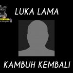 “LUKA LAMA KAMBUH KEMBALI”